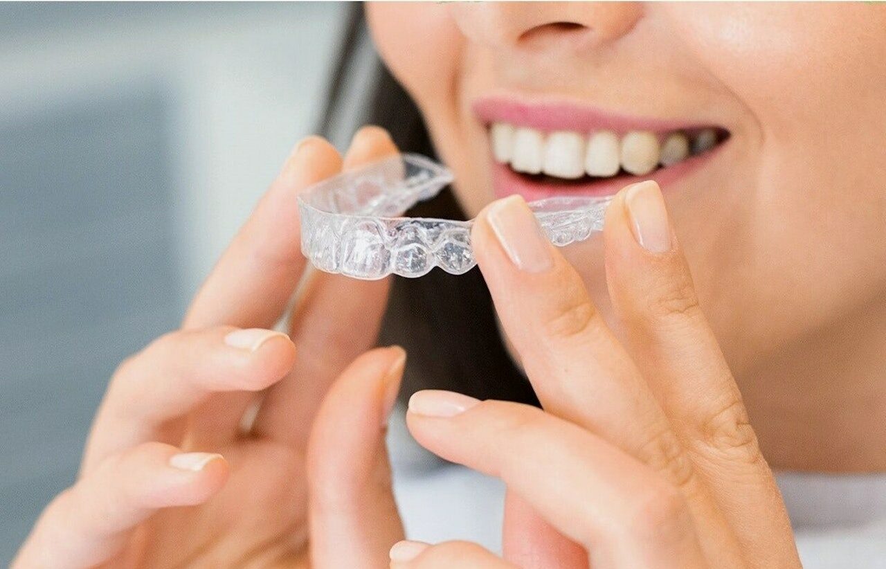 Invisalign Vs Braces Difference To Know Sonneveld Orthodontics 